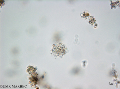 phyto/Bizerte/bizerte_bay/RISCO February 2015/Odontella sp2 (ancien Baie_T5_CW1_Odontella160128_001_ovl-4).tif(copy)_thumb.jpg